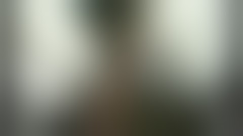 Trichophytic Closure | Dr Junaid Ahmad Consultant Plastic Surgeon