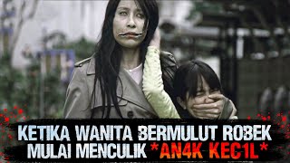 Wanita Bermulut Robek Yg Mulai Menebar Terror!