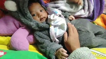 Bayi kuning dan cara mengatasinya