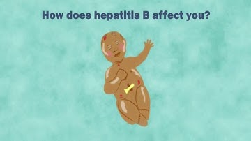 The hepatitis B story - Dari