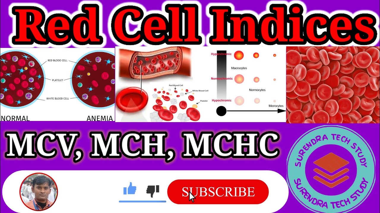 RBC Indices Erythrocyte IndicesHemoglobin, Hematocrit, MCV, MCH