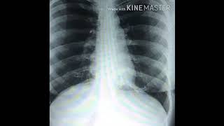 Female Breast View Ray