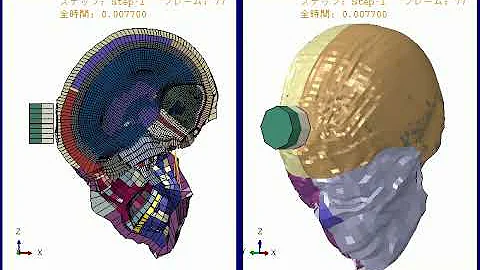 THUMS Head Impact Simulation in Abaqus | Frontal Impact