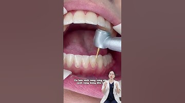 Cuối cùng cũng được tháo niềng rồi !!!! #shortvideo