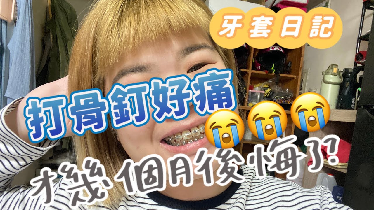 [牙套日記Braces Diary]打骨釘了😭現在後悔來得及嗎？