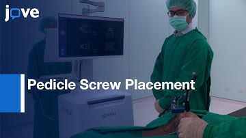 Spine Robotic-Assisted Navigation System For Pedicle Screw Placement l Protocol Preview