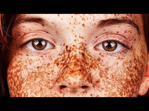 Веснушки – это красиво