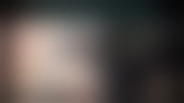 CataractCoach 1530: intra-scleral flange placement