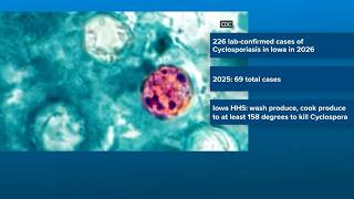 Iowa HHS says 226 lab-confirmed cases of cyclosporiasis have been recorded in Iowa this year