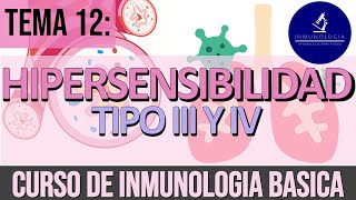 Hipersensibilidad tipo 3 y 4 | Deposito de inmnunocomplejos  Hipersensibilidad retardada