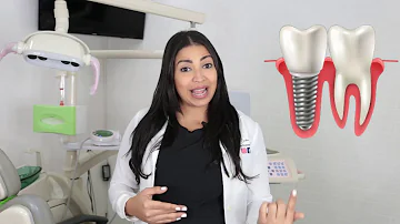 ¿Por qué elegir un puente dental en lugar de un implante?