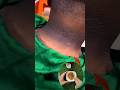 Dark & Dirt Neck/Feet Cleaning Tips | Get Fair Neck/Remove Neck/Feet Tanning #ytshorts #shorts