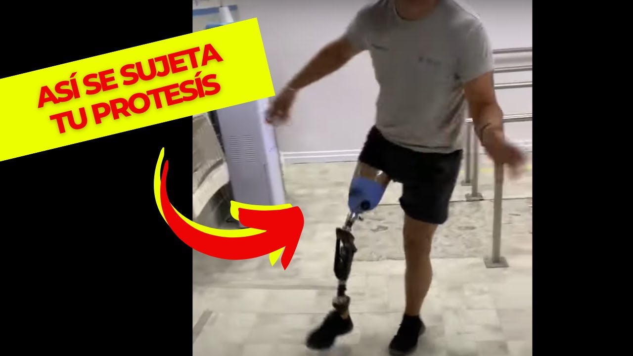 Episodio 106 Como se sujeta una prótesis , succión liner de anillos y succión directa a la piel.