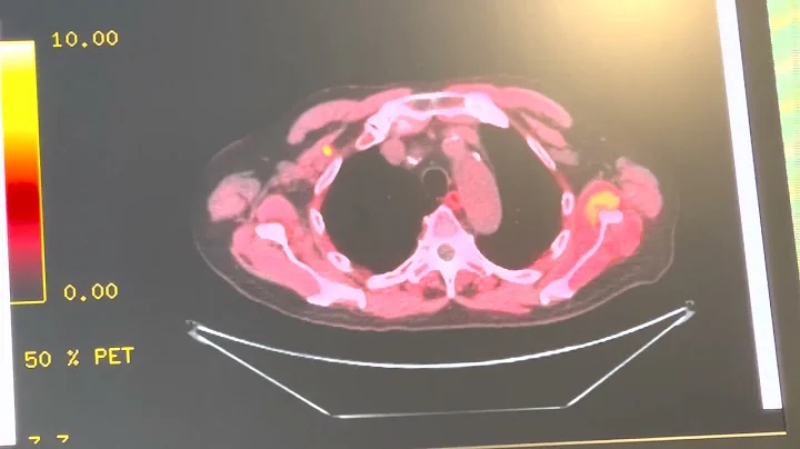Dr. Edward Schaeffer's Interesting Case of the Week