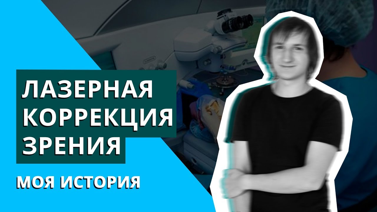Лазерная коррекция зрения | Как это было | Сколько стоит? - YouTube