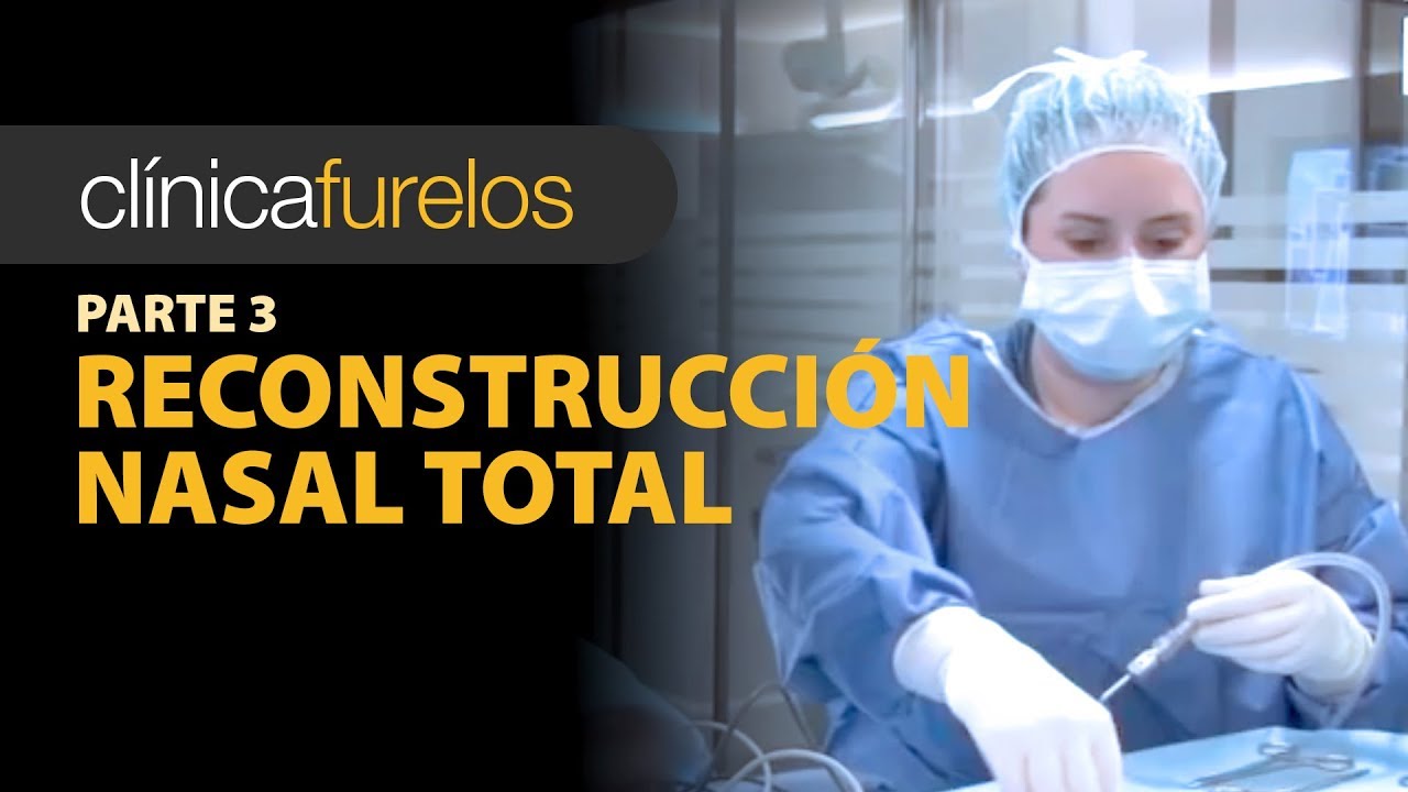Reconstrucción nasal total - (Parte 3) facial mask