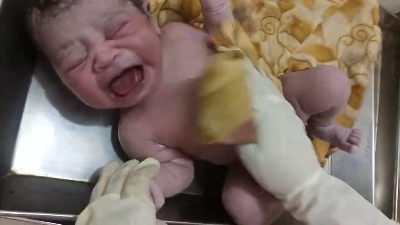 cleaning of amniotic fluid just after birth first look of newborn baby