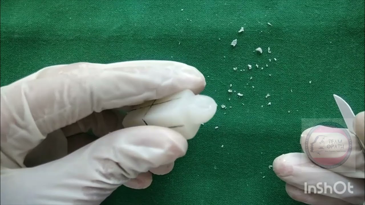 Dental Anatomy Carving - Permanent Maxillary Canine