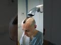 This Tiny Robot Instantly Transforms Bald Heads – You Won't Believe the Result!