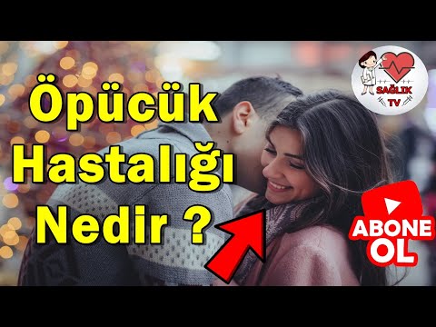 Öpücük hastalığı nedir? l Belirtileri ve tedavi yöntemleri nelerdir?