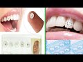 Diamond Bur Dental Material Teeth Whitening Studs Denture Acrylic Teeth Crystal #short