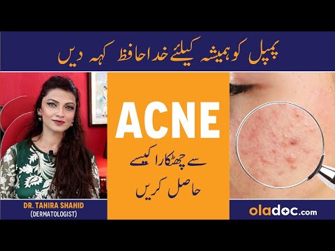 How To Get Rid Of Pimples - Chehre Ke Dane Khatam Karne Ka Tarika - Remove Acne From Your Face