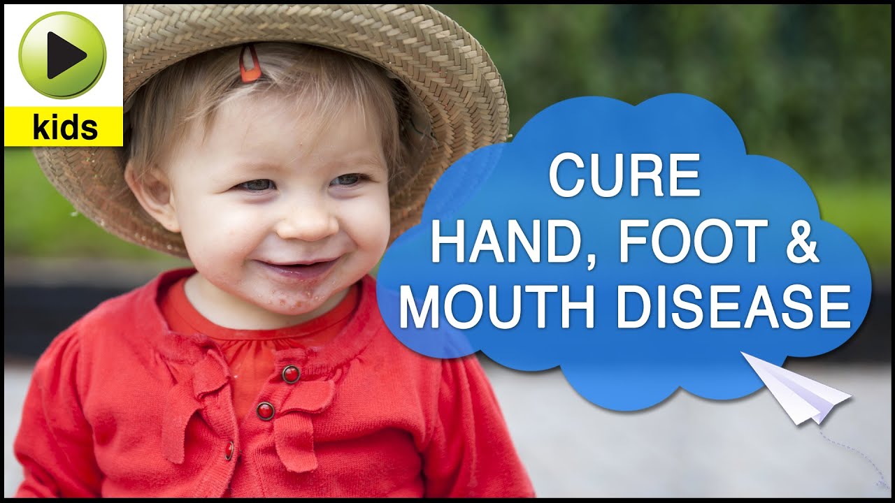 Kids Health Hand Foot And Mouth Disease Natural Home Remedies For