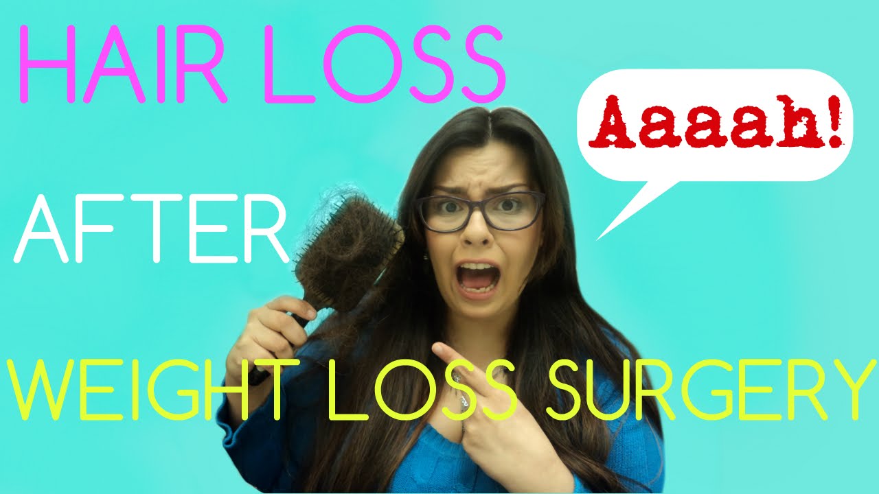 Hair Loss After Weight Loss Surgery Clipzuicom