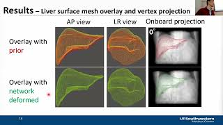 Real-time Liver Tumor Localization via a Single X-ray Projection Using Deep Graph Network-assisted..