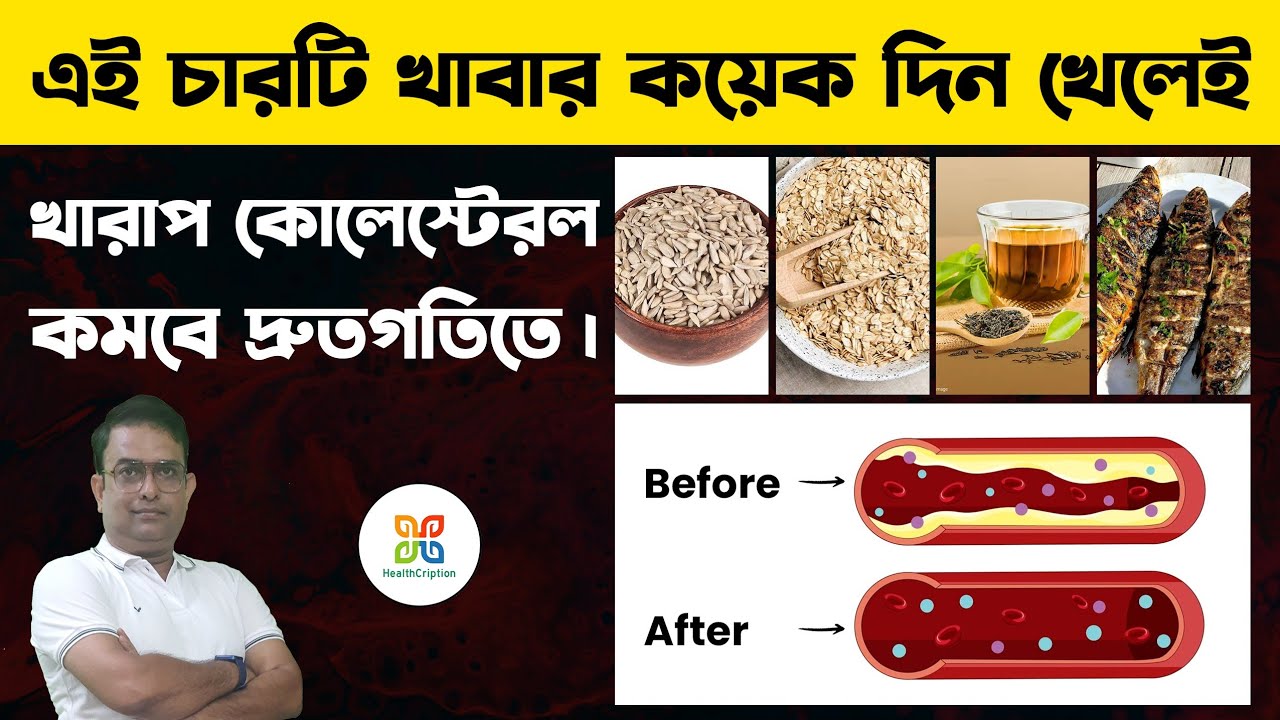 খারাপ কোলেস্টেরল কম করতে এই ৪ ধরনের খাবার নিয়মিত খান।4 types of food to lower cholesterol naturally