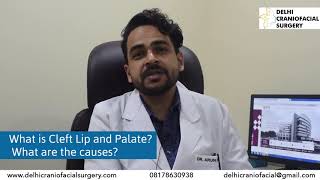 What is Cleft Lip and Palate What are the causes