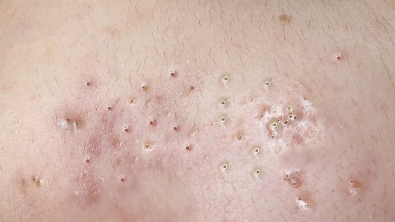 Satisfying Relaxing with Sac Dep Spa Video (#129)