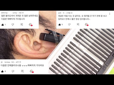 역대급 시원한 귀청소 asmr 😪 점착 면봉, 괄사 ear cleaning real person