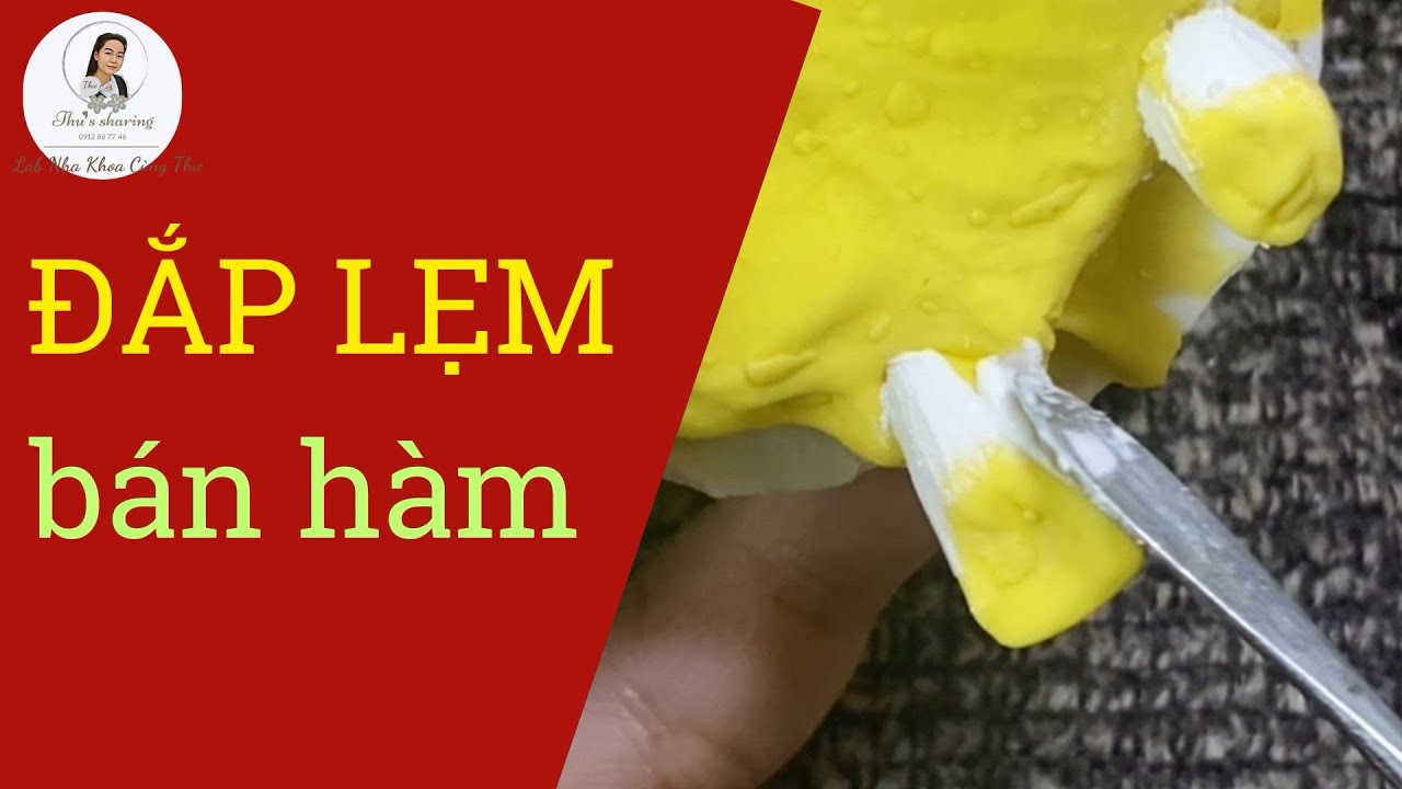 ĐẮP LẸM bán hàm II Chi tiết