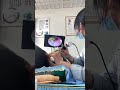 耳垢そうじ/耳が痒くなった鼓膜に付着した軟耳垢/ #shorts