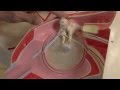 Auditory System: Neuroanatomy Video Lab - Brain Dissections