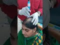 #hair regrowth #hair fall#alopecia#knee#skin#hair protocol