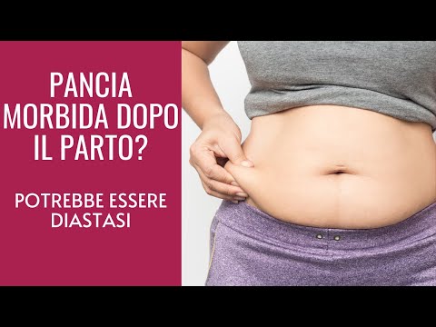 Video: Come Sbarazzarsi Di Una Pancia Flaccida Dopo Il Parto