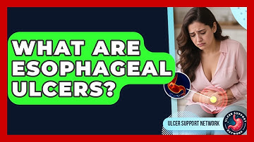What Are Esophageal Ulcers? - Ulcer Support Network