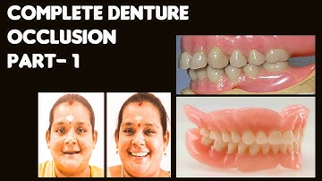 Complete Denture Occlusion Part 1