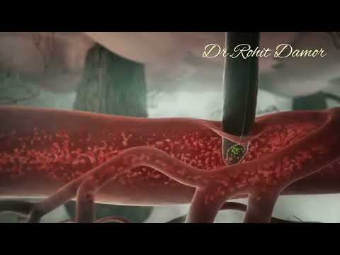 Malaria 3D Animation Shows How the Infection Spreads in the Body