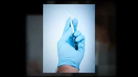 A Patient's Guide to Liposuction by Jeffry B. Scha...