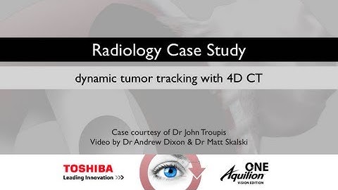 TOSHIBA Aquilion presents: 4D CT in Lung Cancer Staging