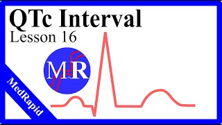 Qt Interval Qtc