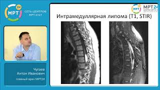 МРТ  в диагностике онкологических заболеваний спинного мозга