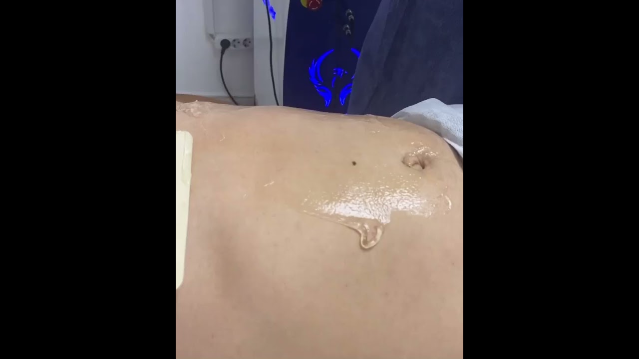 Magic probe Heykeltraş zayıflama 2-12 cm arası incelme