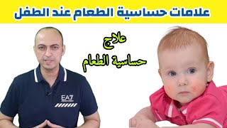 علامات تحذرك من حساسية طفلك لبعض الاطعمة ، و كيفية علاج الطفل من حساسية الطعام - دكتور حاتم فاروق