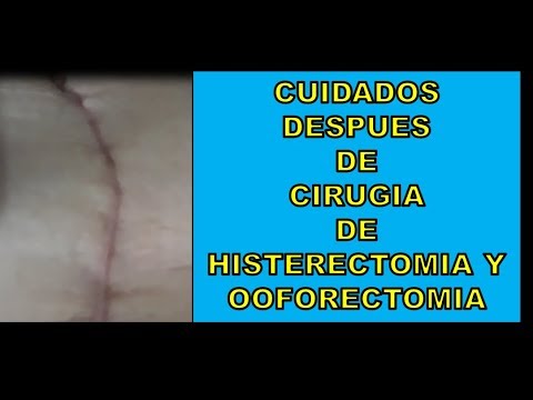 Vídeo: Cicatriz De Histerectomía: Imágenes Y Qué Esperar Después De Una Histerectomía