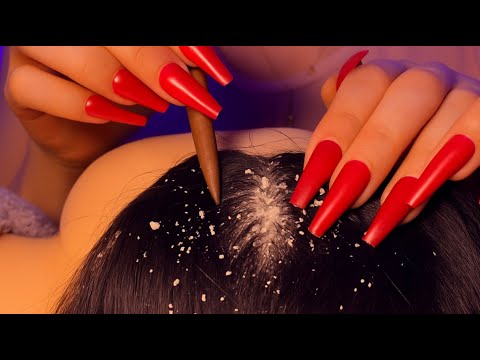 INSANE Dandruff Removal🔎, ASMR Dandruff ✨, Calming Scalp Check, Relaxing Scalp Scratching