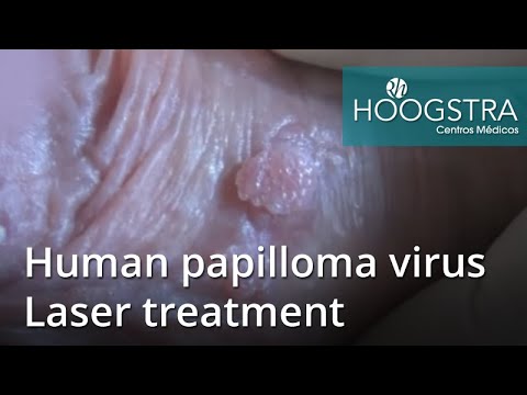 Video: Papillomer Under Armene: årsager Til Udseende, Behandling, Foto